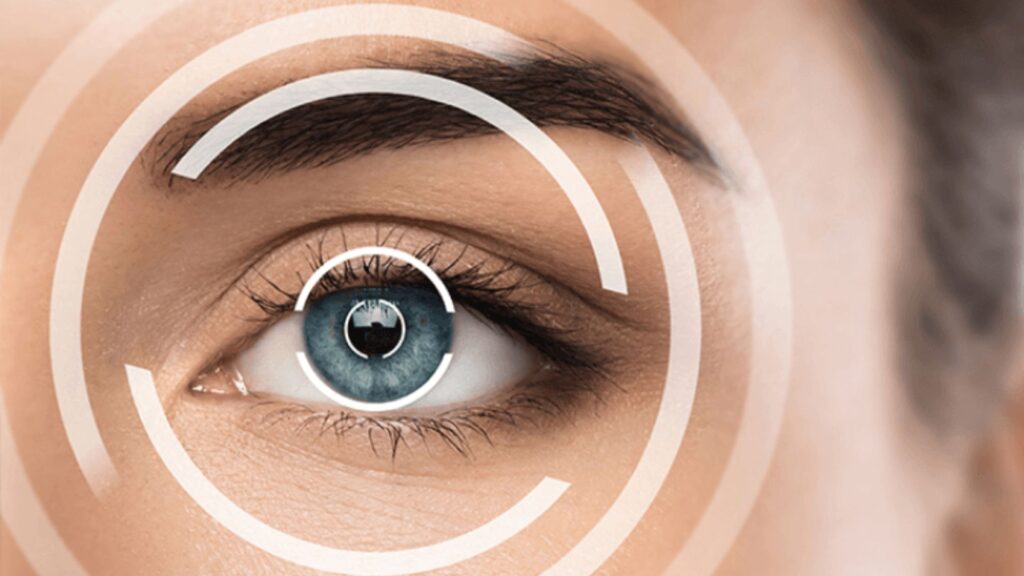 Refractive Surgery